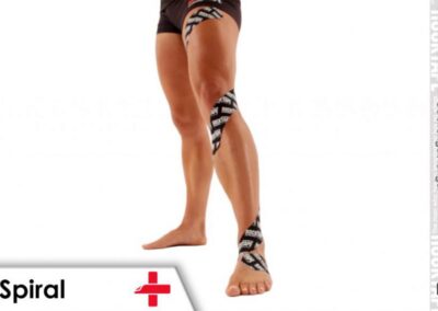 Twisted Taping:  Spiral Techniques for Three Lower Limb Conditions
