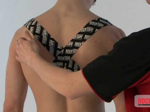 Kinesiology Taping in the Chiropractic Clinic