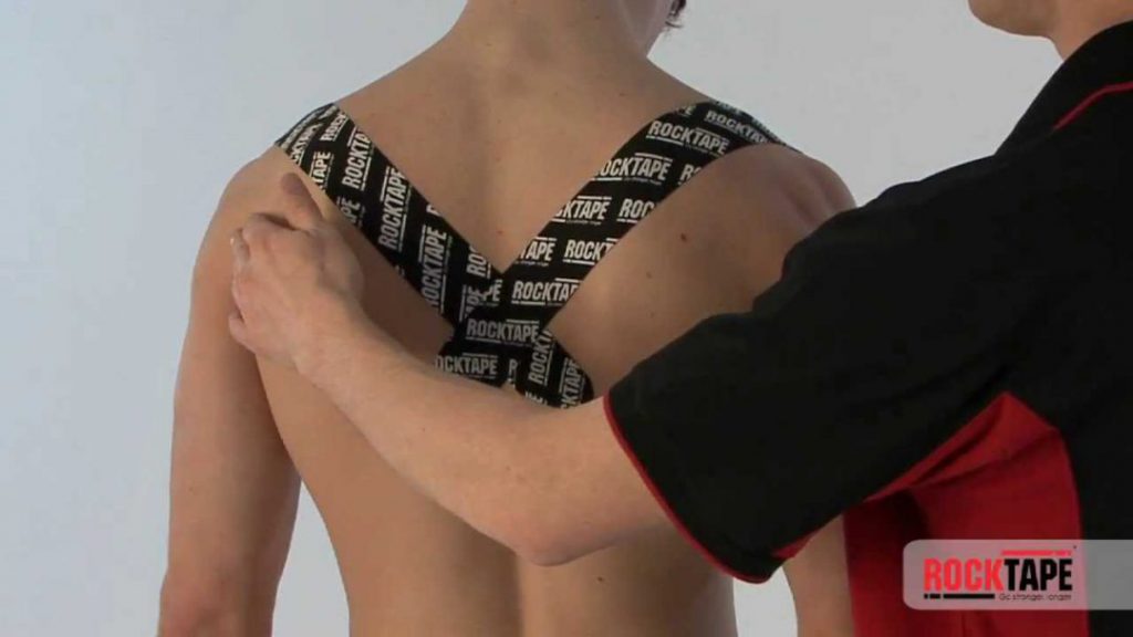 Kinesiology Taping in the Chiropractic Clinic